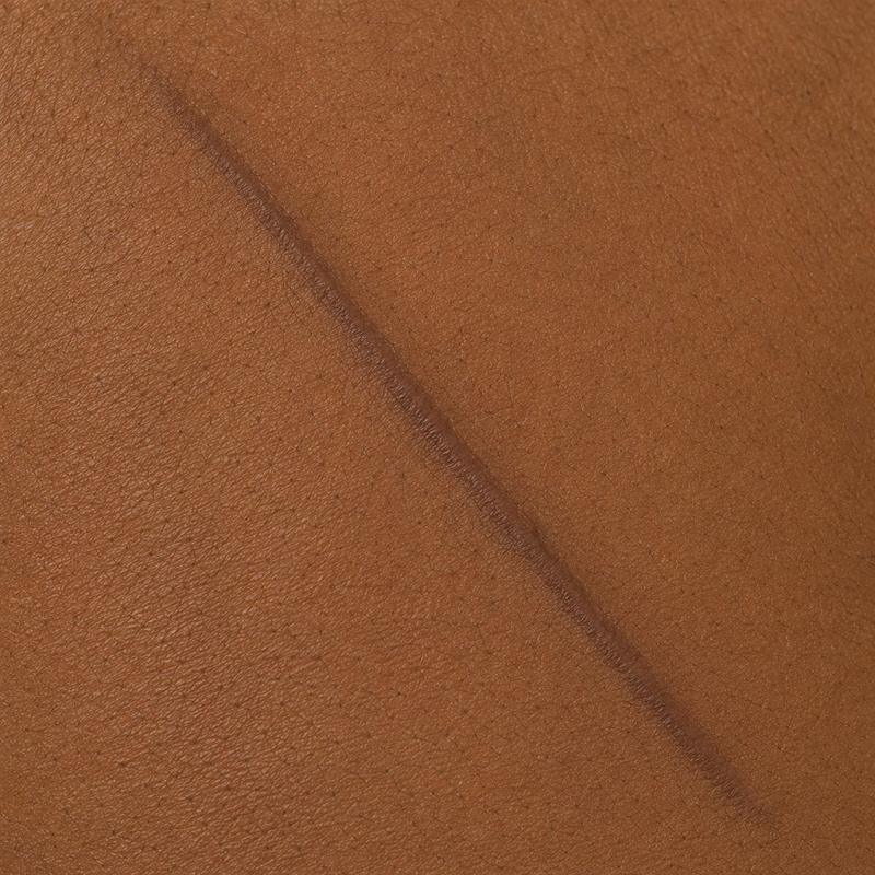 Scar and reconstruction